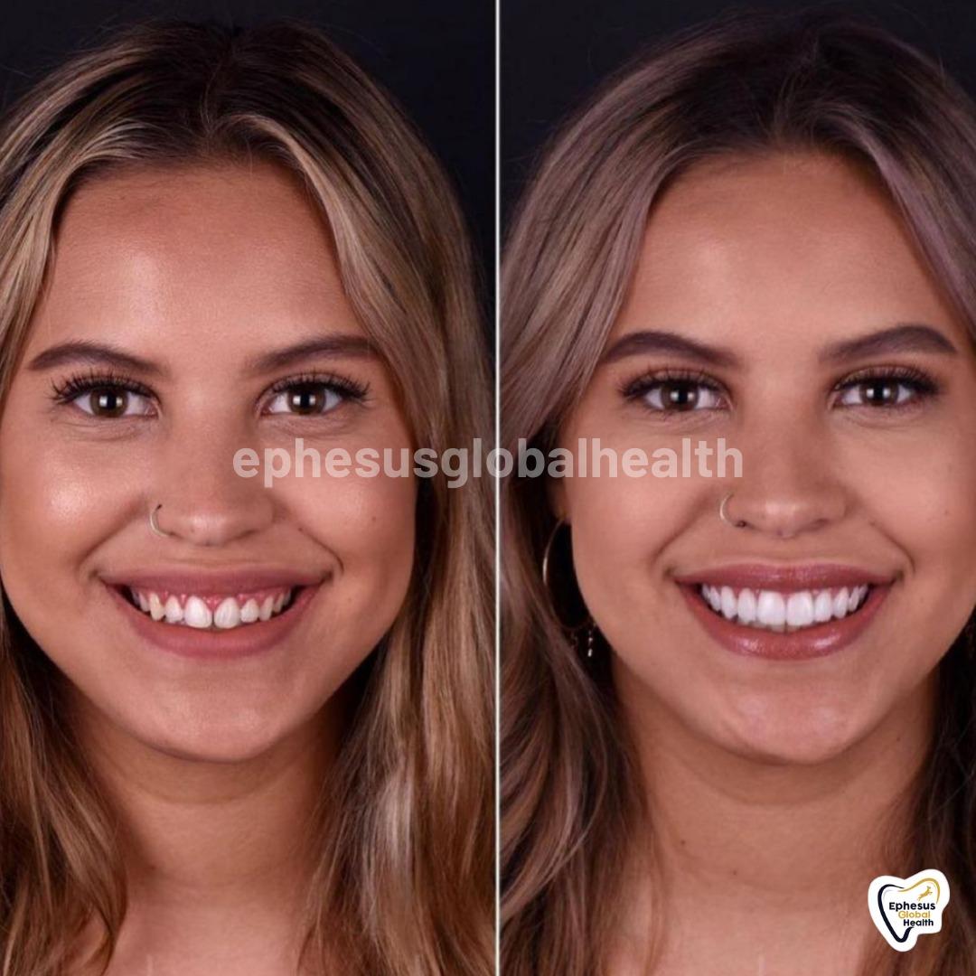 Ephesus dental results26