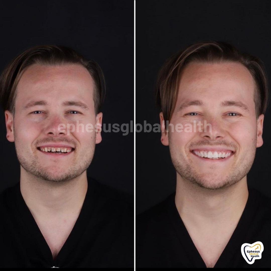 Ephesus dental results25