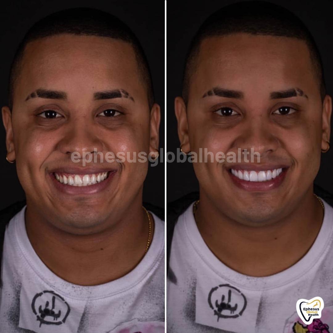 Ephesus dental results24