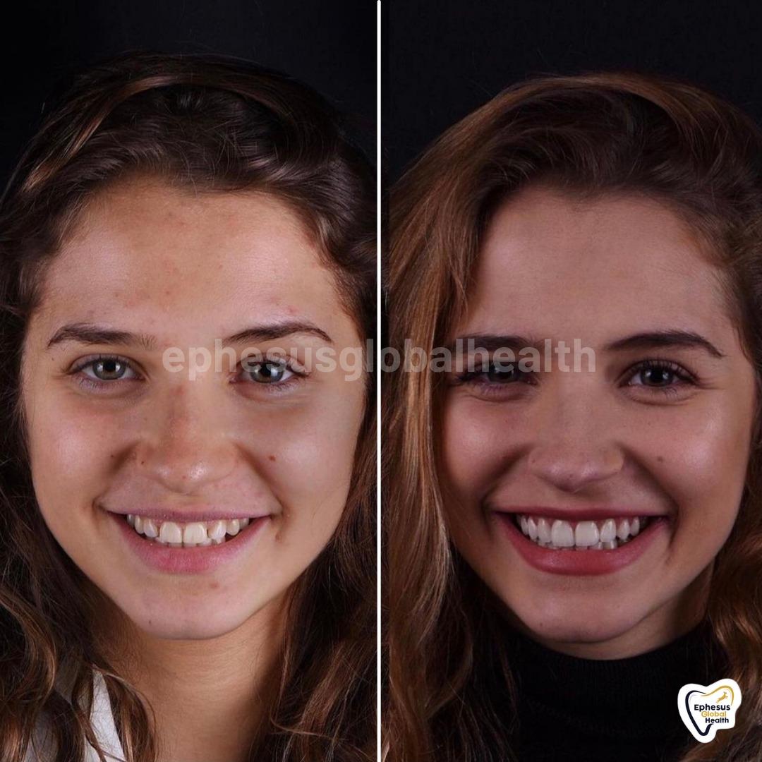 Ephesus dental results23