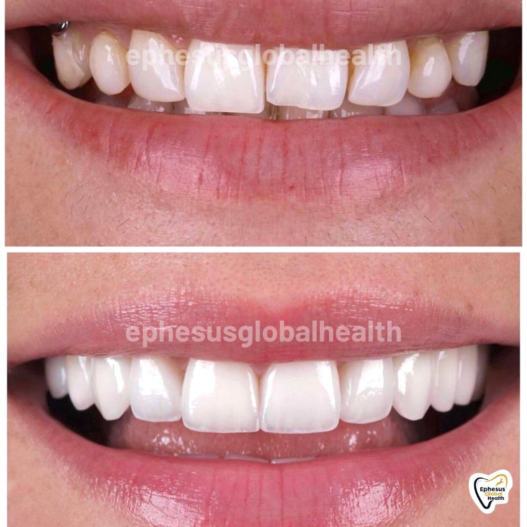 Ephesus dental results22