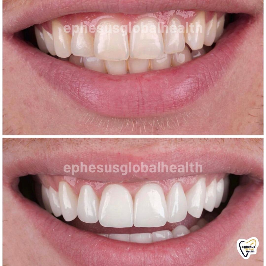 Ephesus dental results20