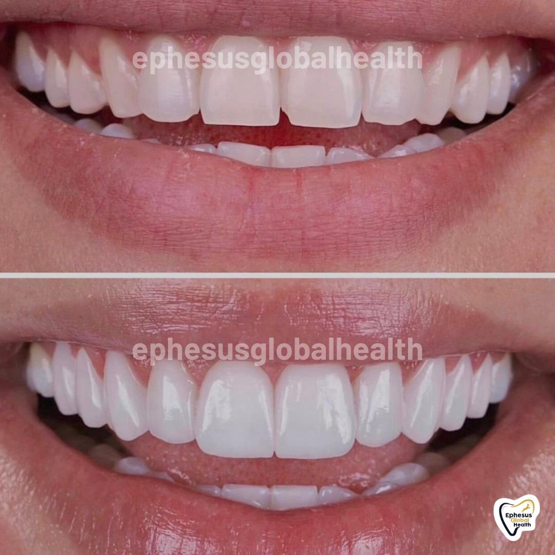 Ephesus dental results18