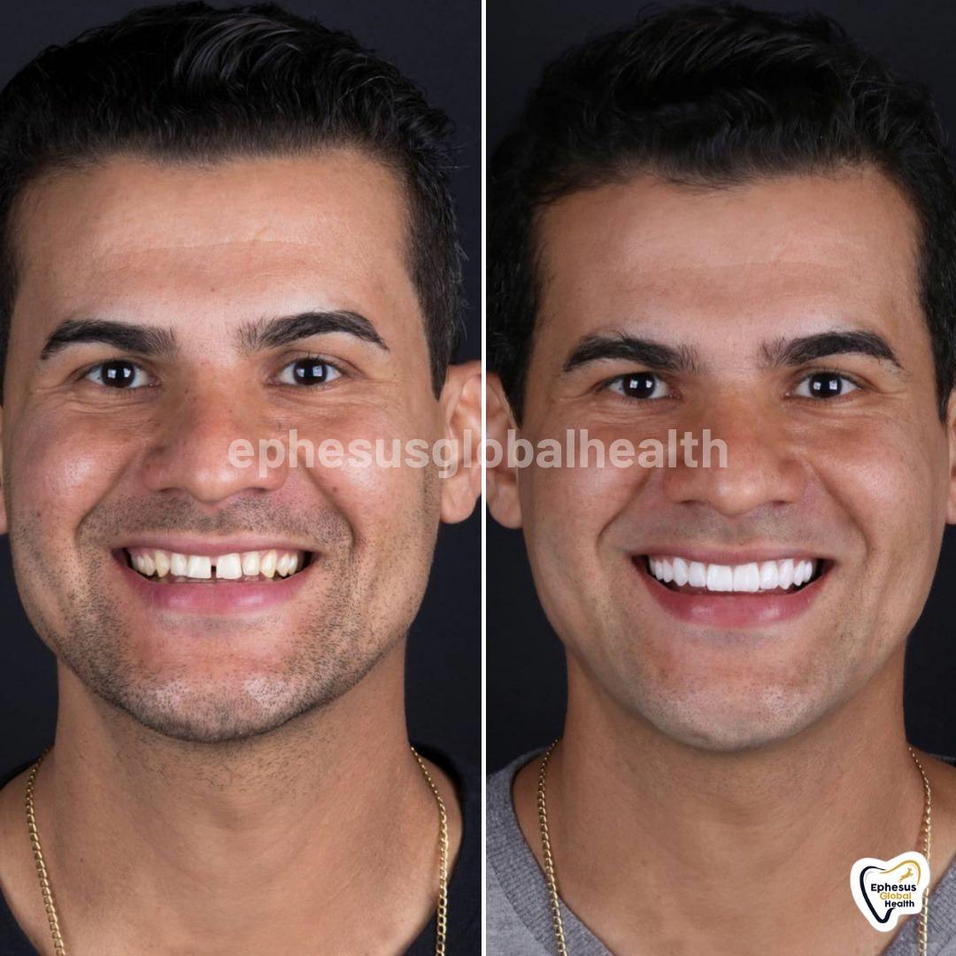 Ephesus dental results17