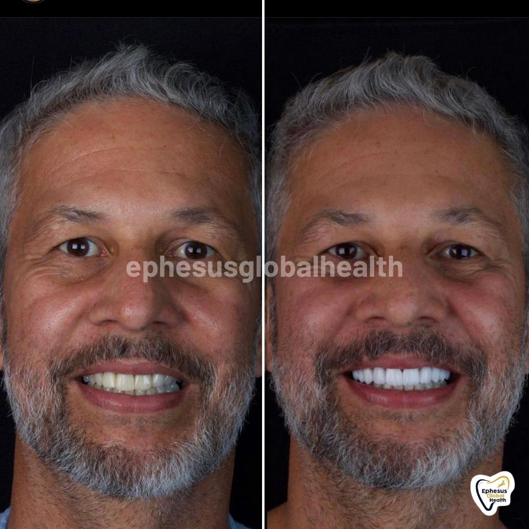 Ephesus dental results16