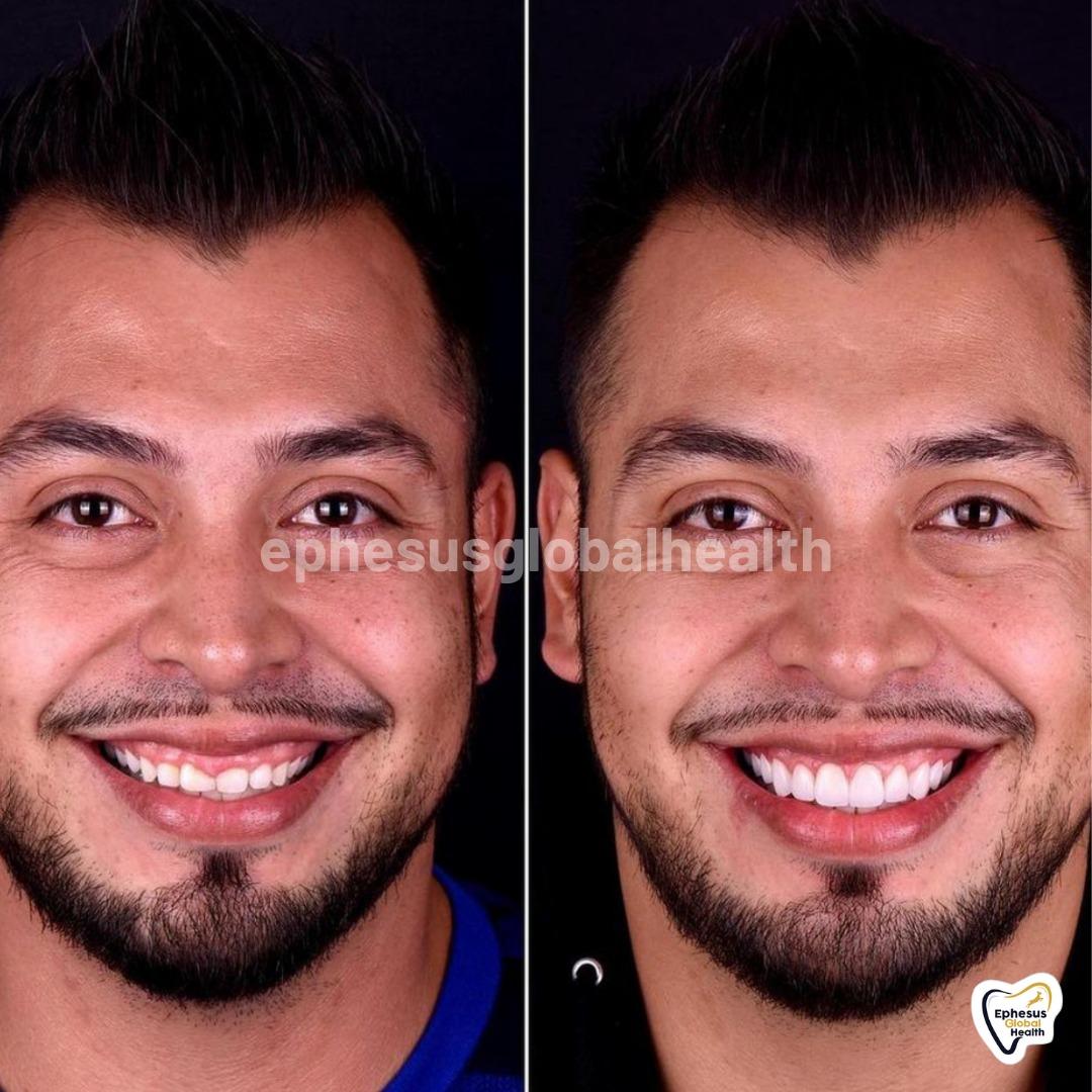 Ephesus dental results15