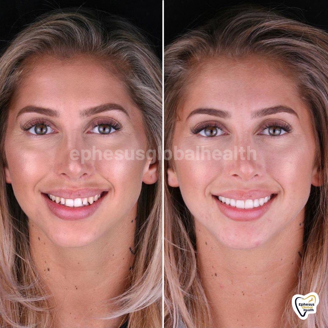 Ephesus dental results14