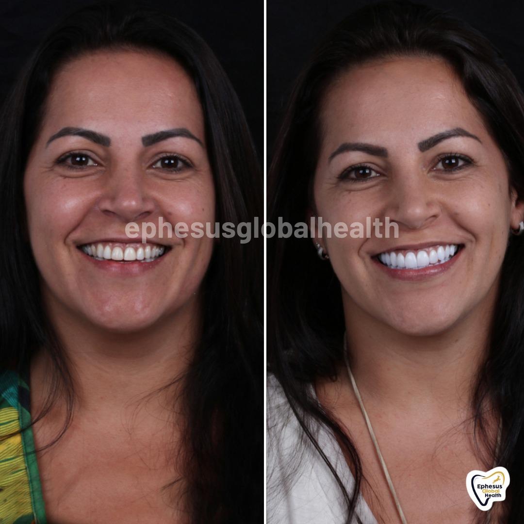 Ephesus dental results13