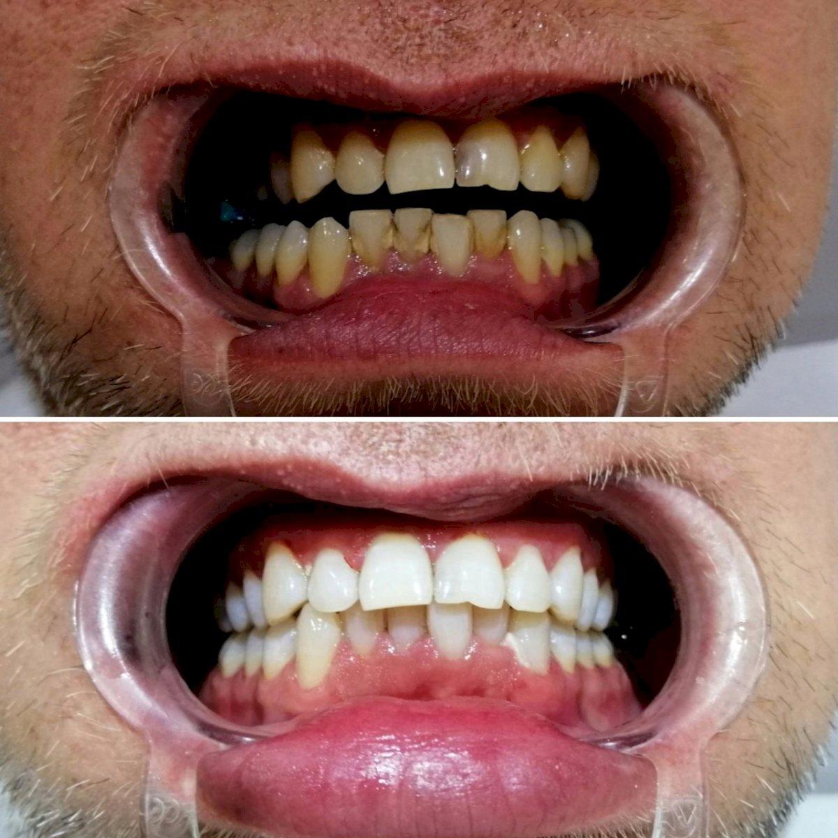 Ephesus dental results11