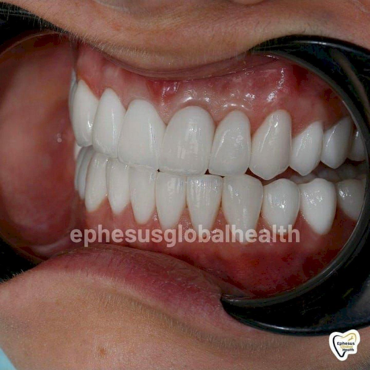 Ephesus dental results10