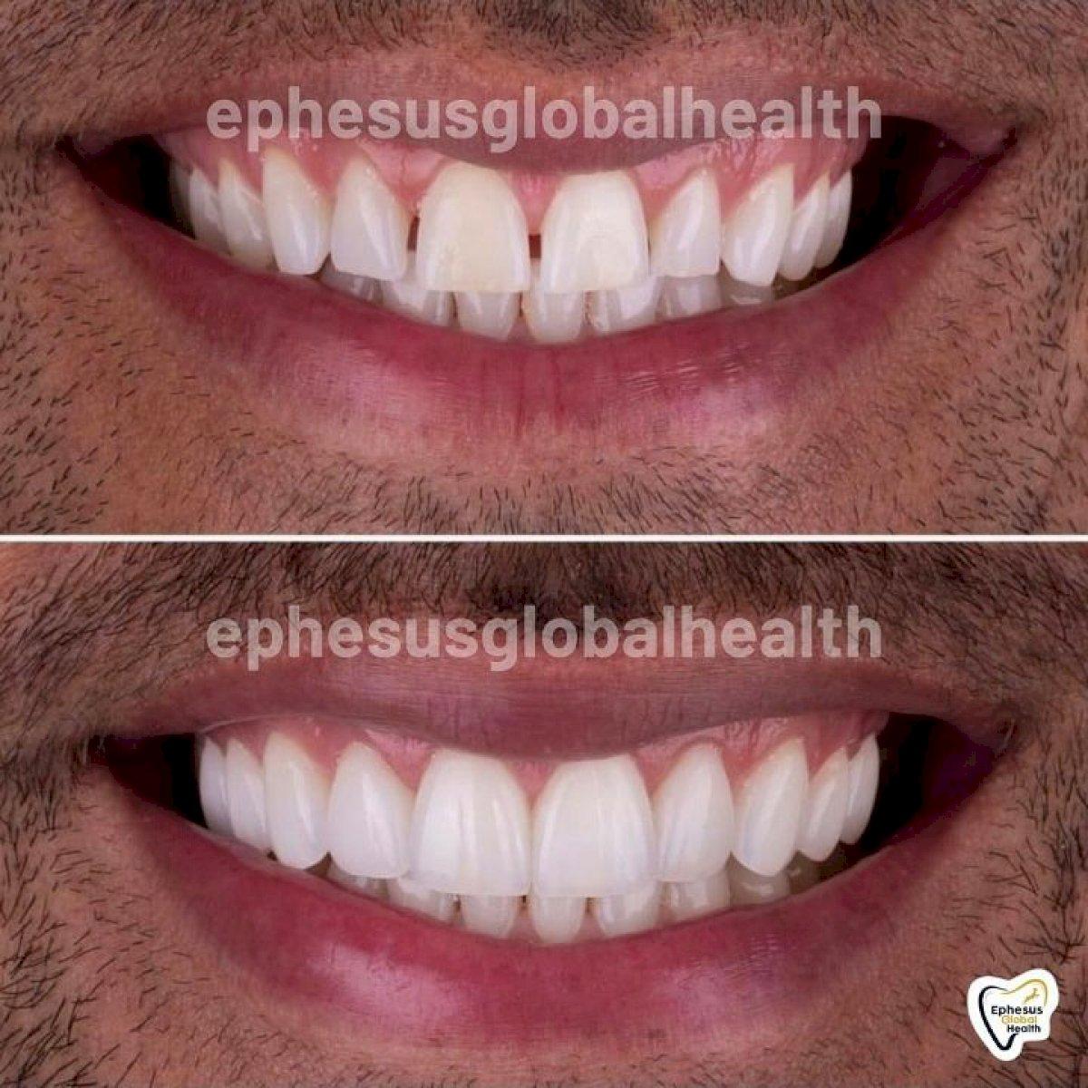 Ephesus dental results9