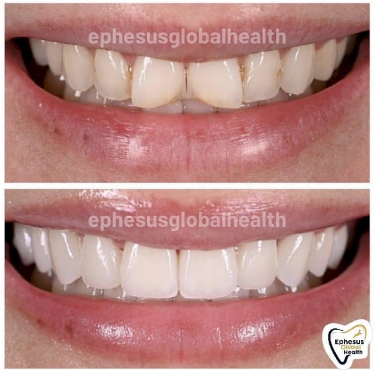 Ephesus dental results8