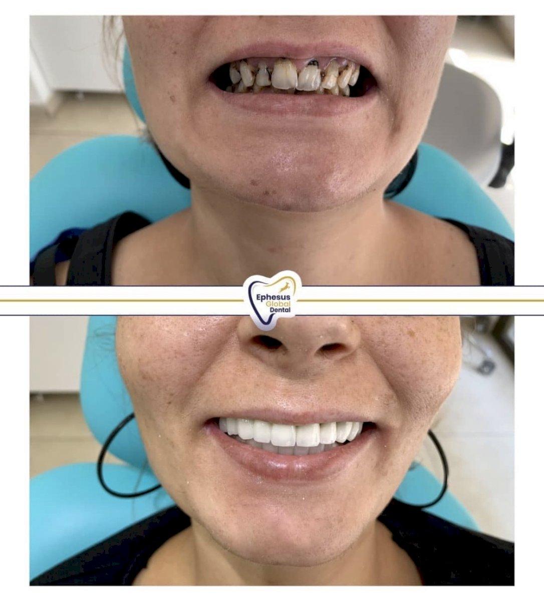 Ephesus dental results7