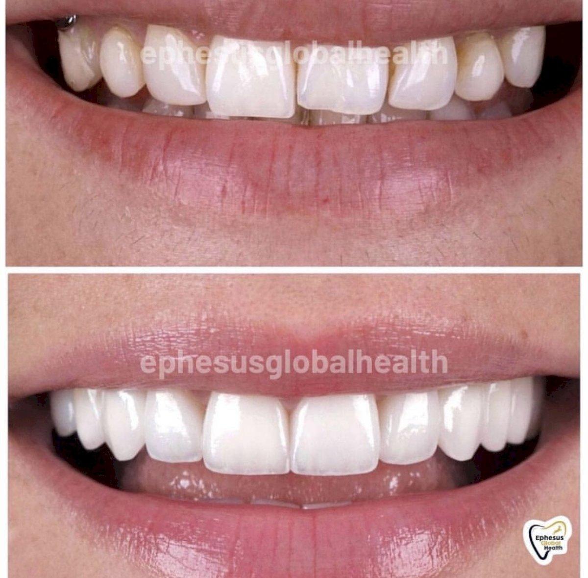 Ephesus dental results6