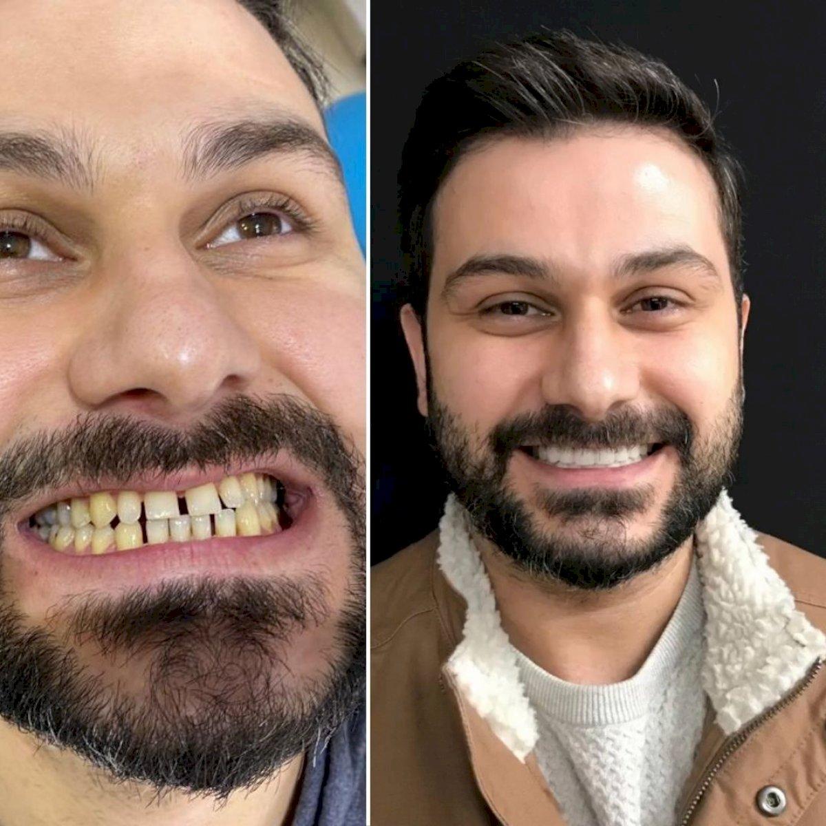 Ephesus dental results5