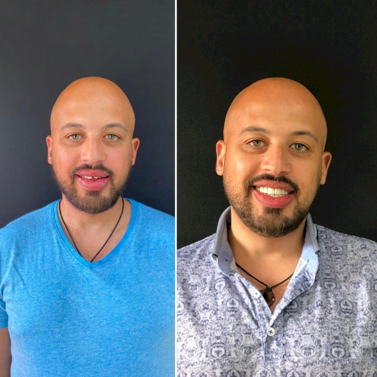 Ephesus dental results3