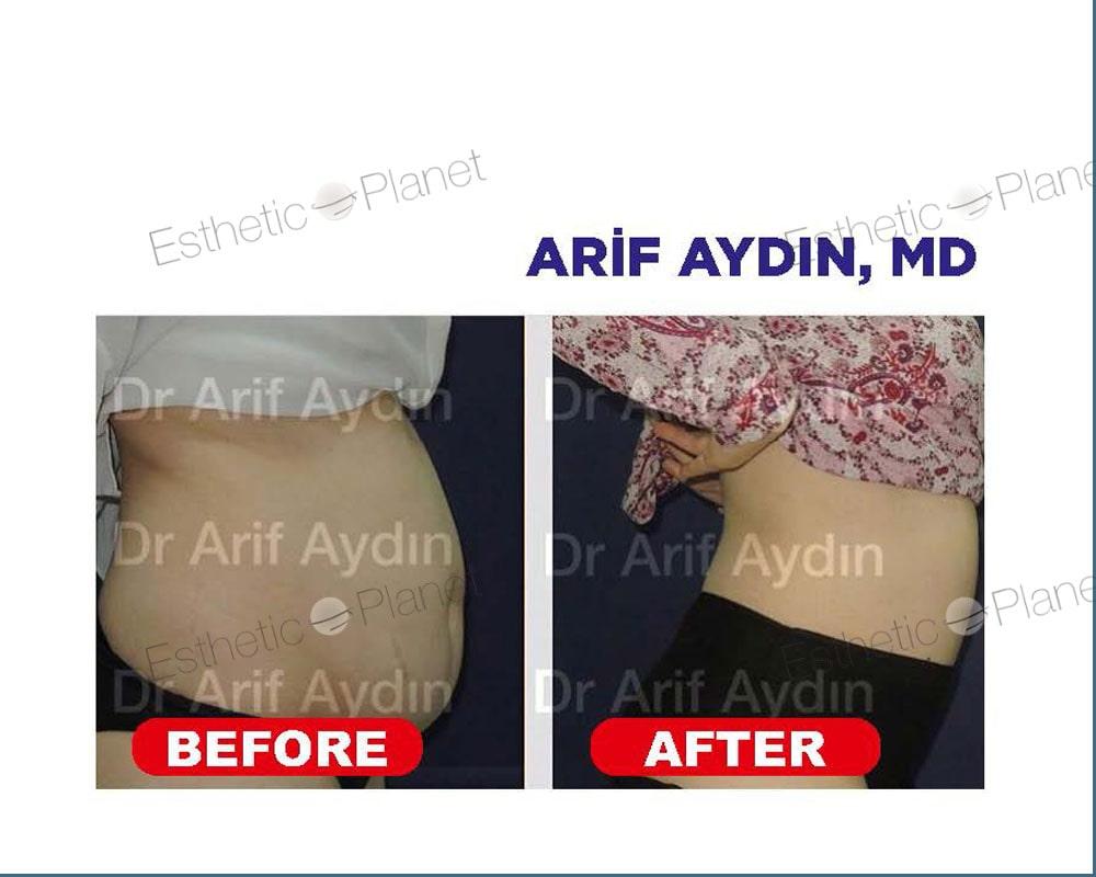 abdo2-min