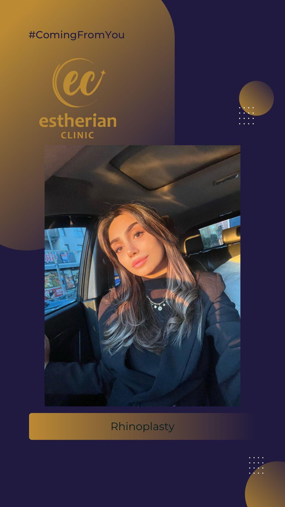 estherian Face Surgery 2