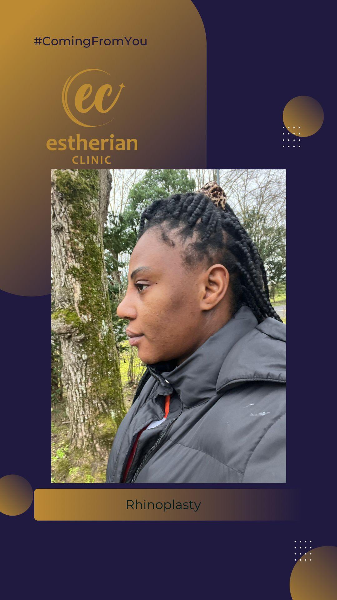 estherian Face Surgery 3