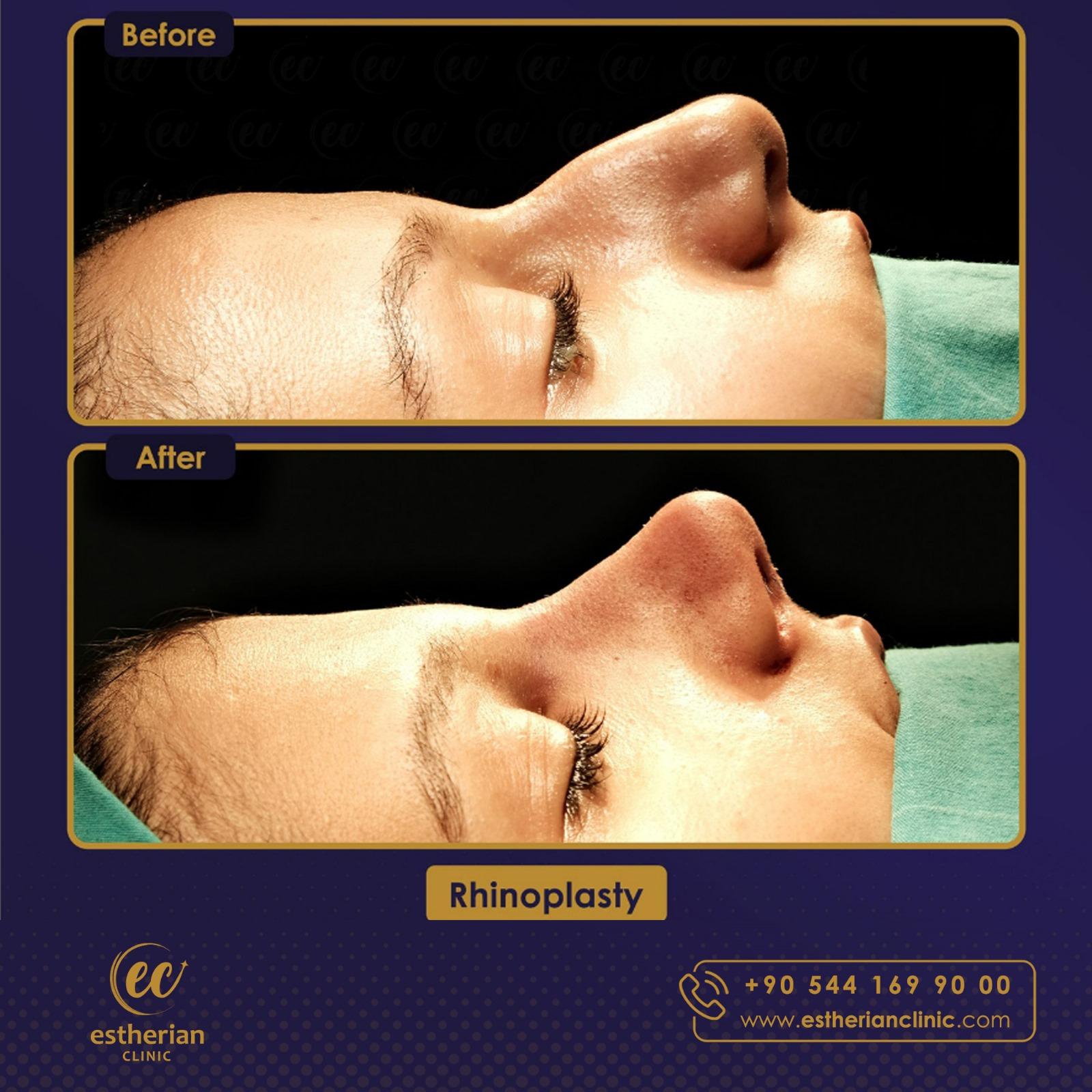 estherian Face Surgery 5