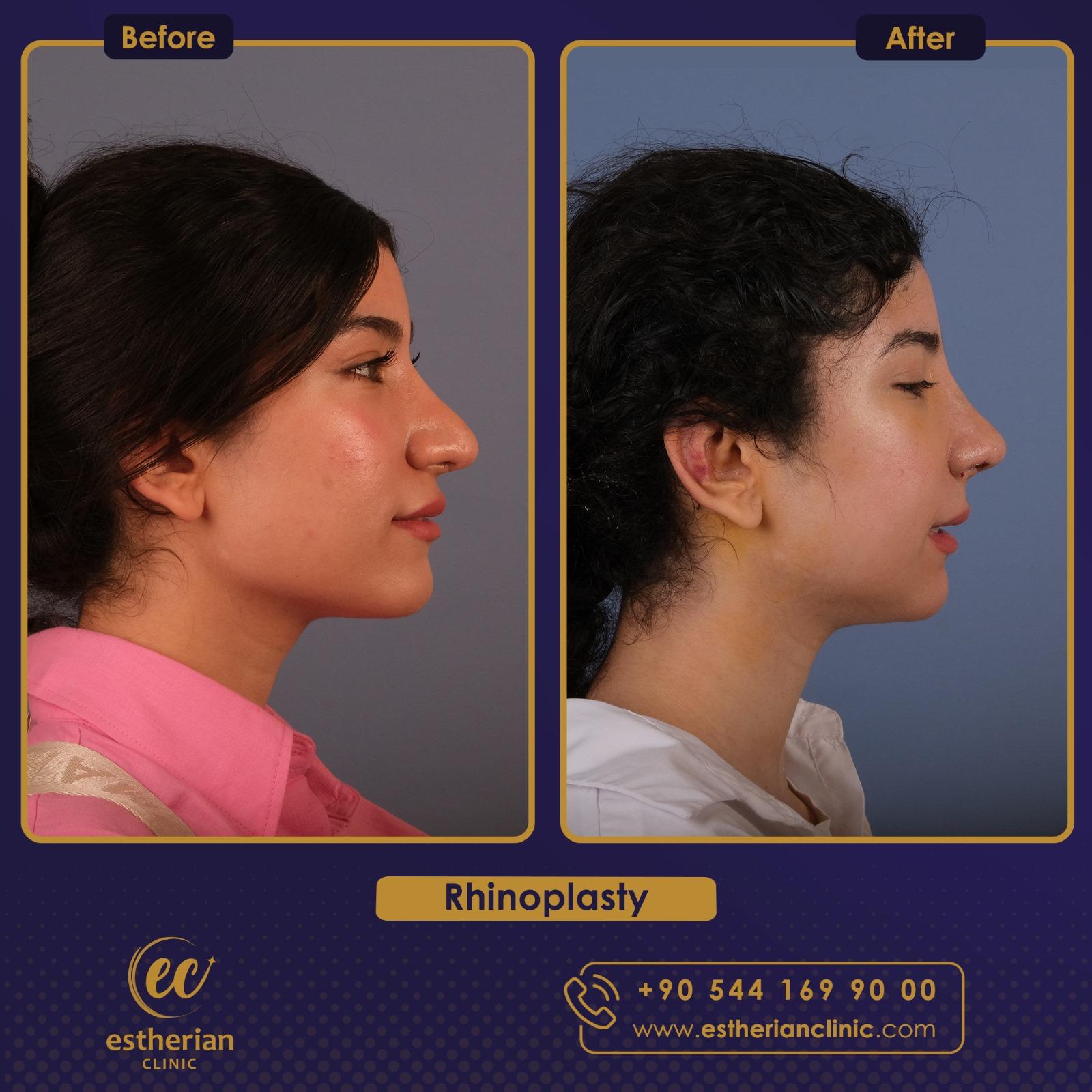 estherian Face Surgery 8
