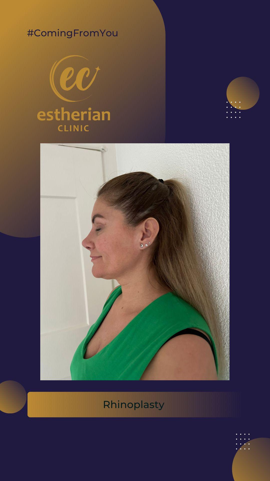estherian Face Surgery 9