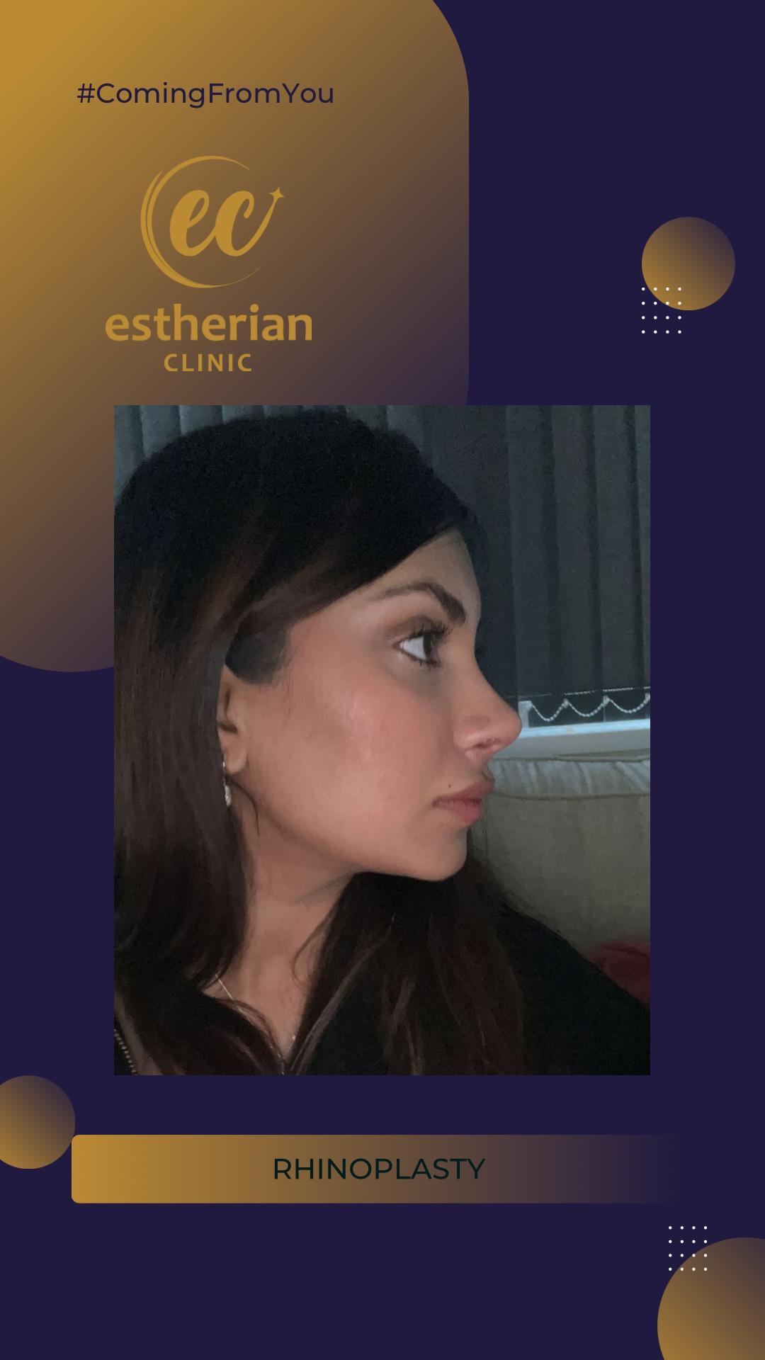 estherian Face Surgery 10