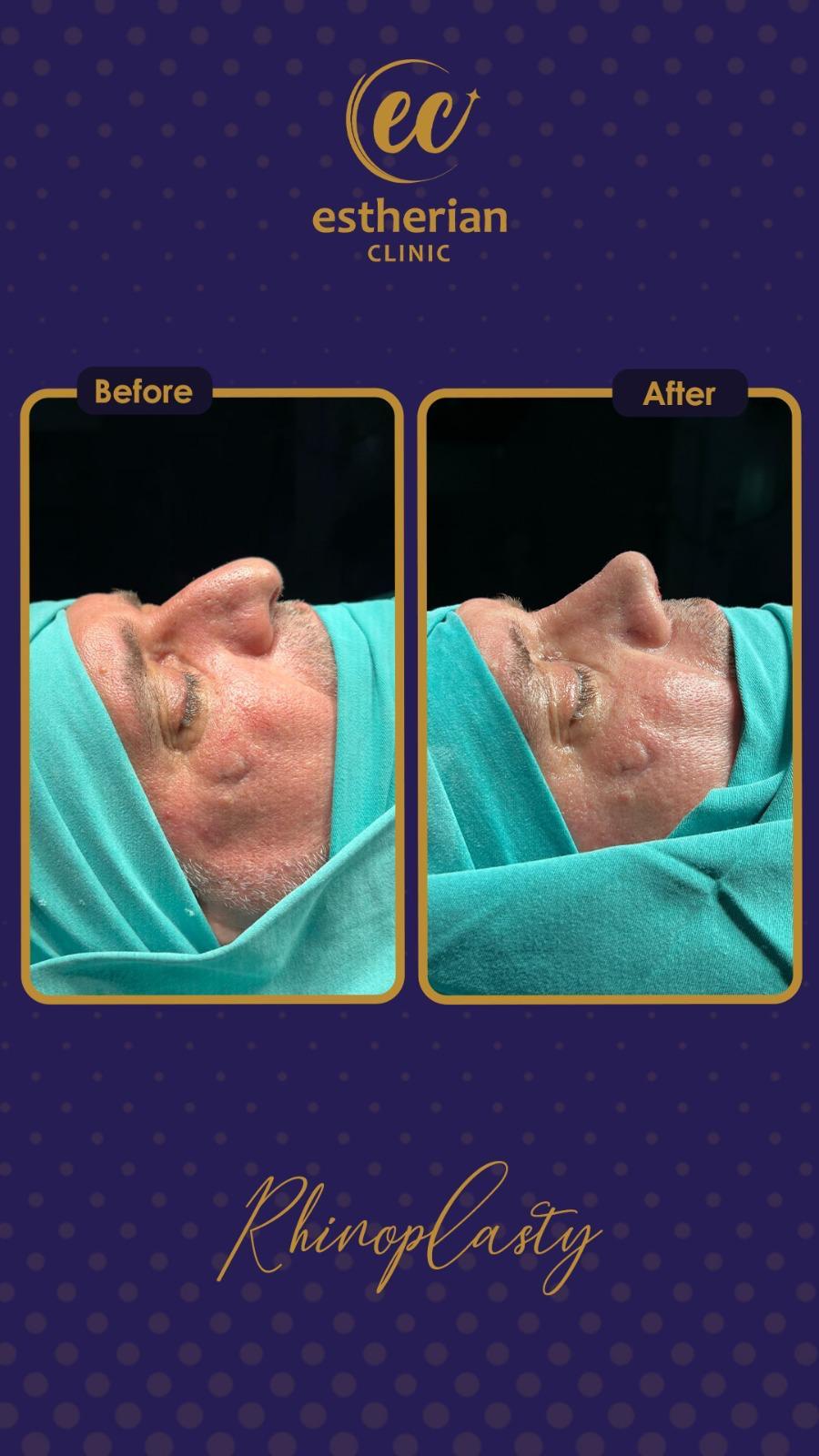 estherian Face Surgery 15-min