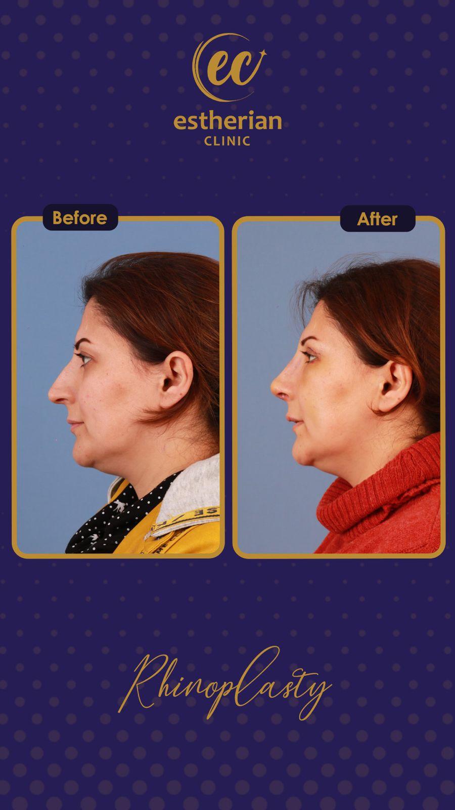 estherian Face Surgery 20-min