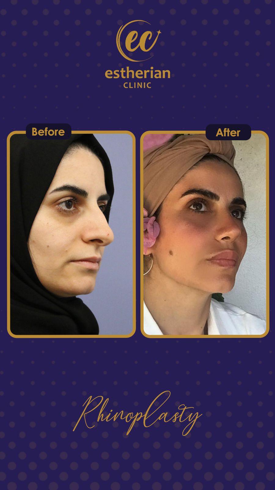 estherian Face Surgery 24-min