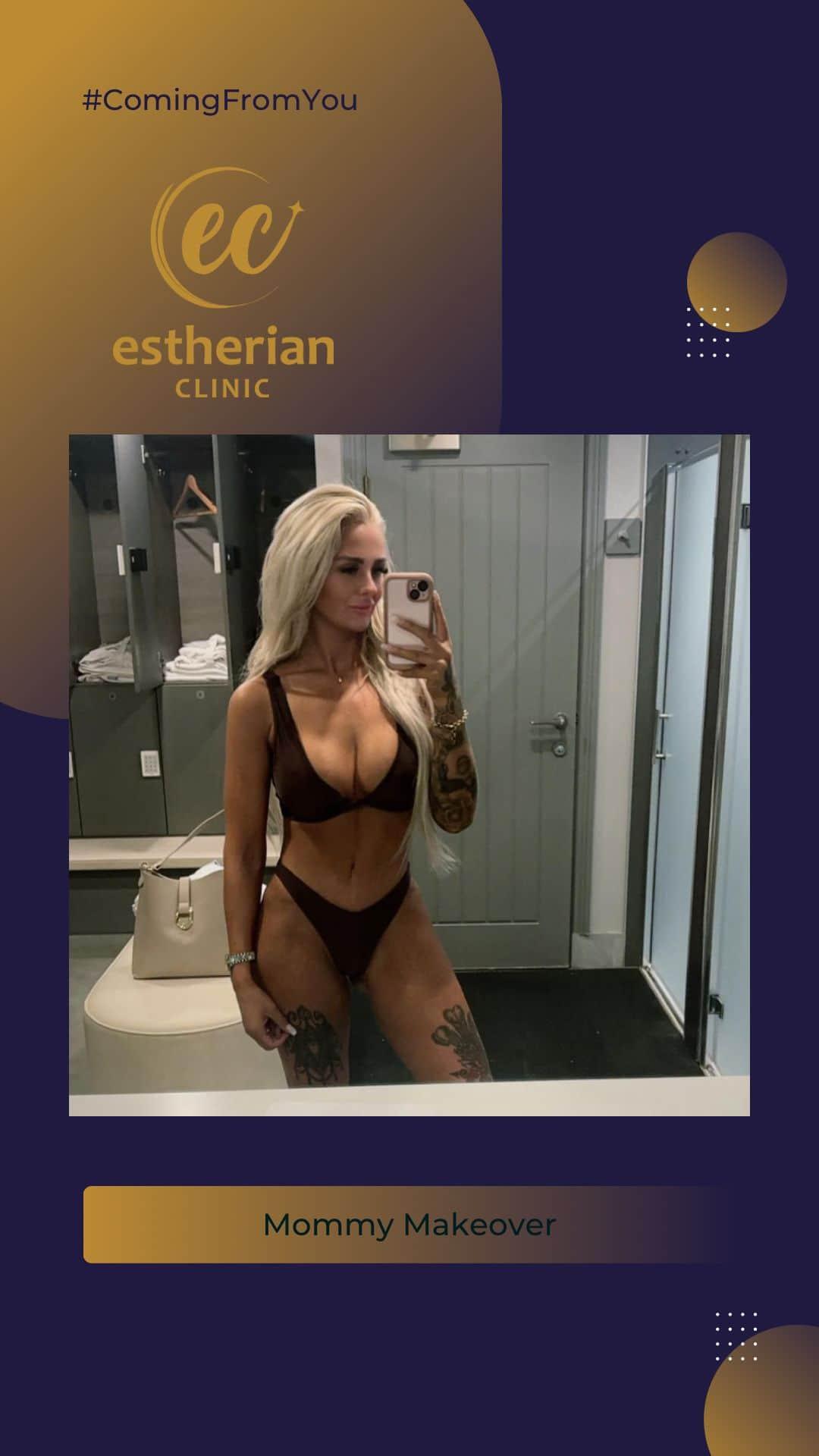 estherian BODY Surgery 2-min