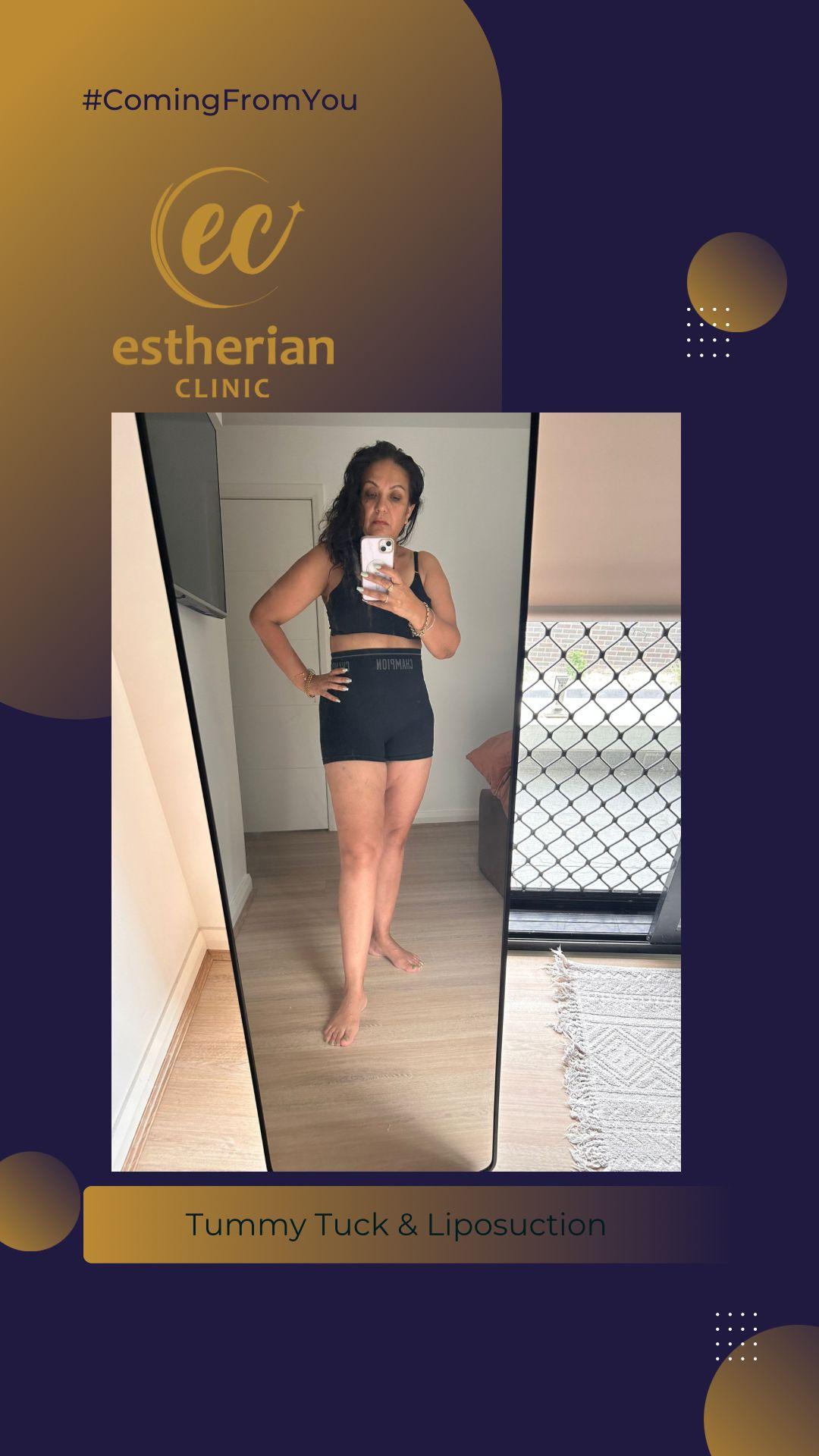 estherian BODY Surgery 7-min-1