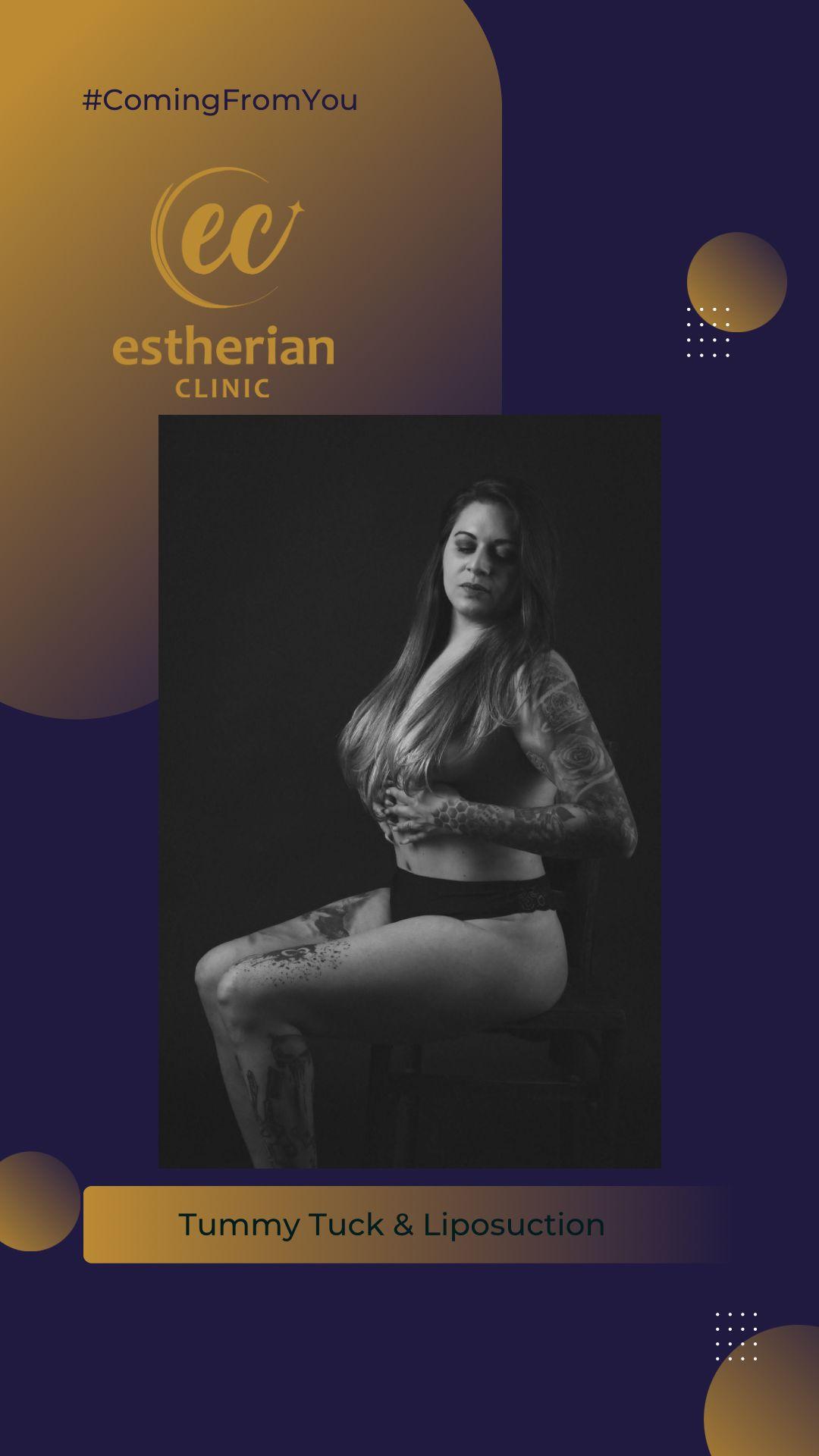 estherian BODY Surgery 8-min