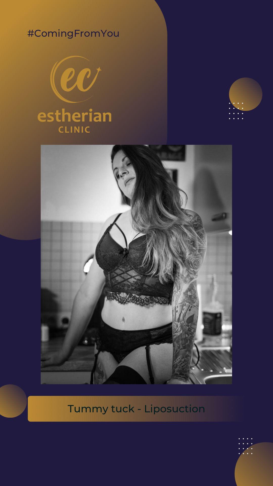 estherian BODY Surgery 9-min