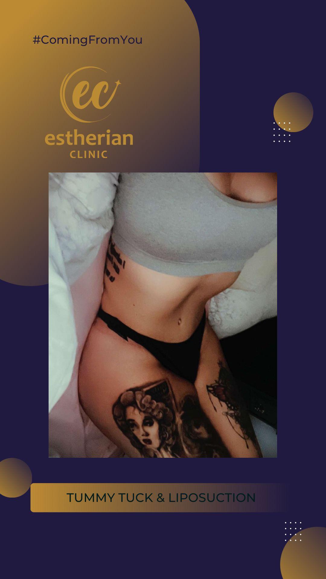estherian BODY Surgery 18-min