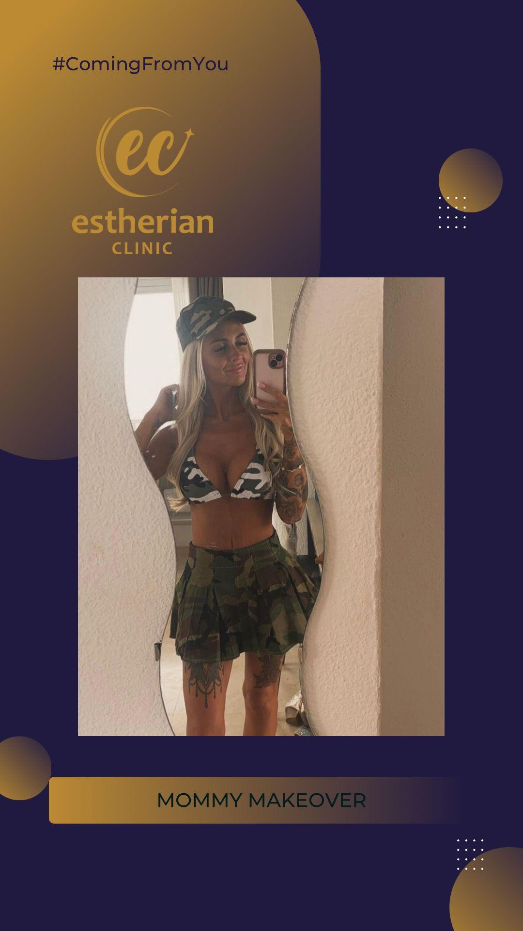 estherian BODY Surgery 19-min