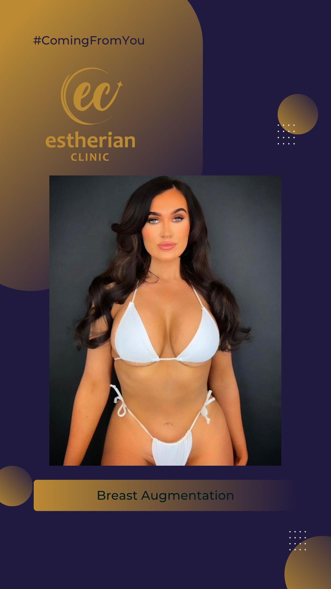 estherian Breast Surgery 8