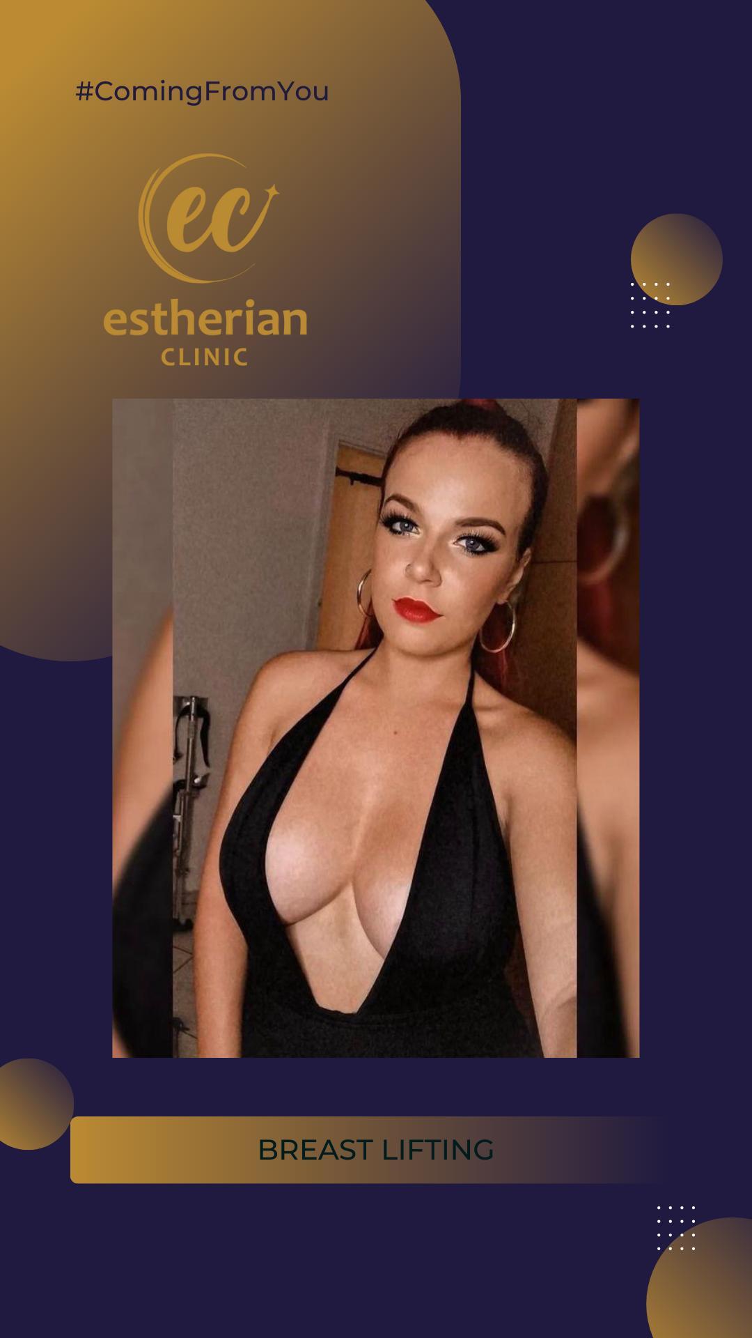 estherian Breast Surgery 10