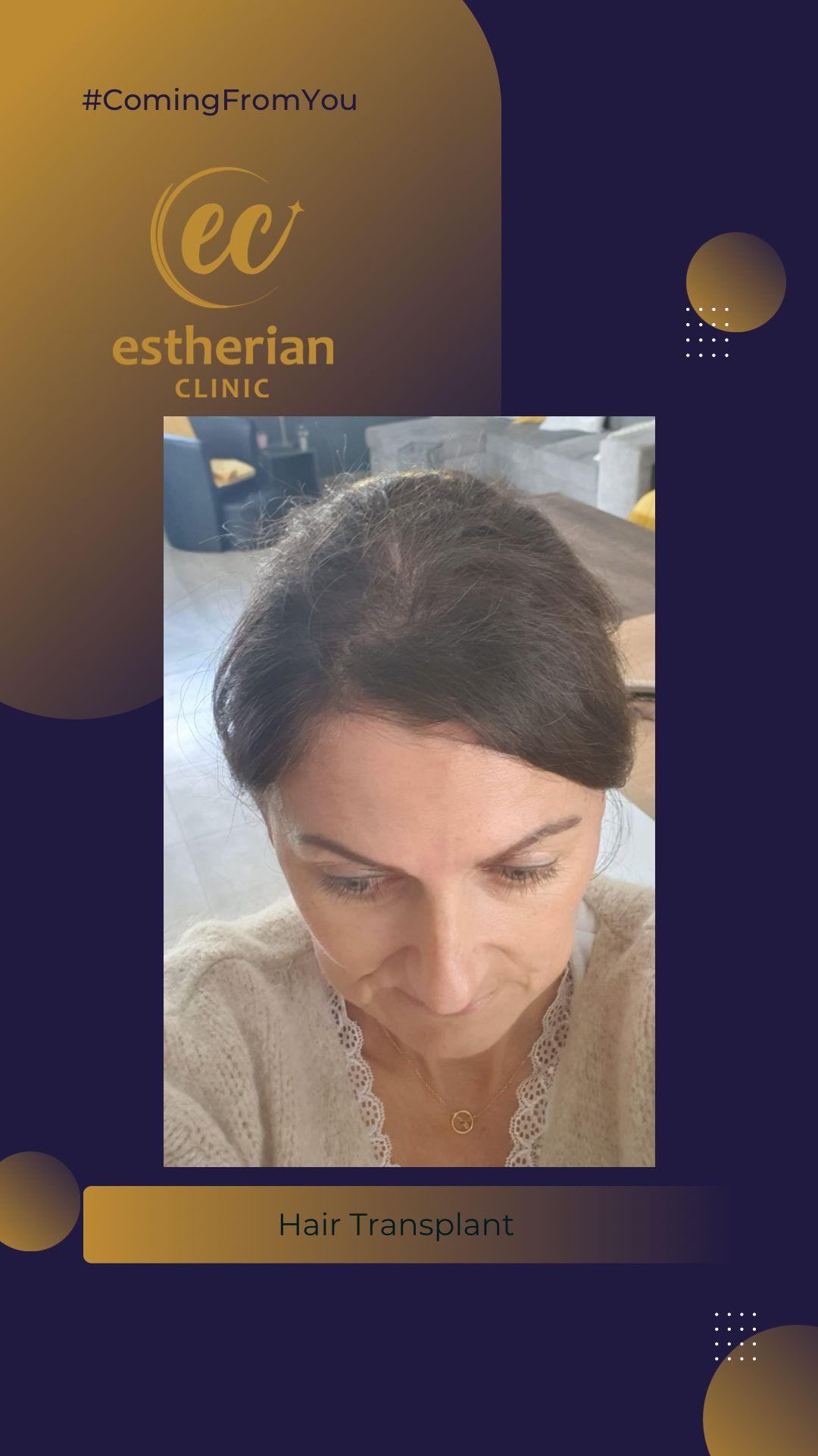estherian Hair Surgery 3