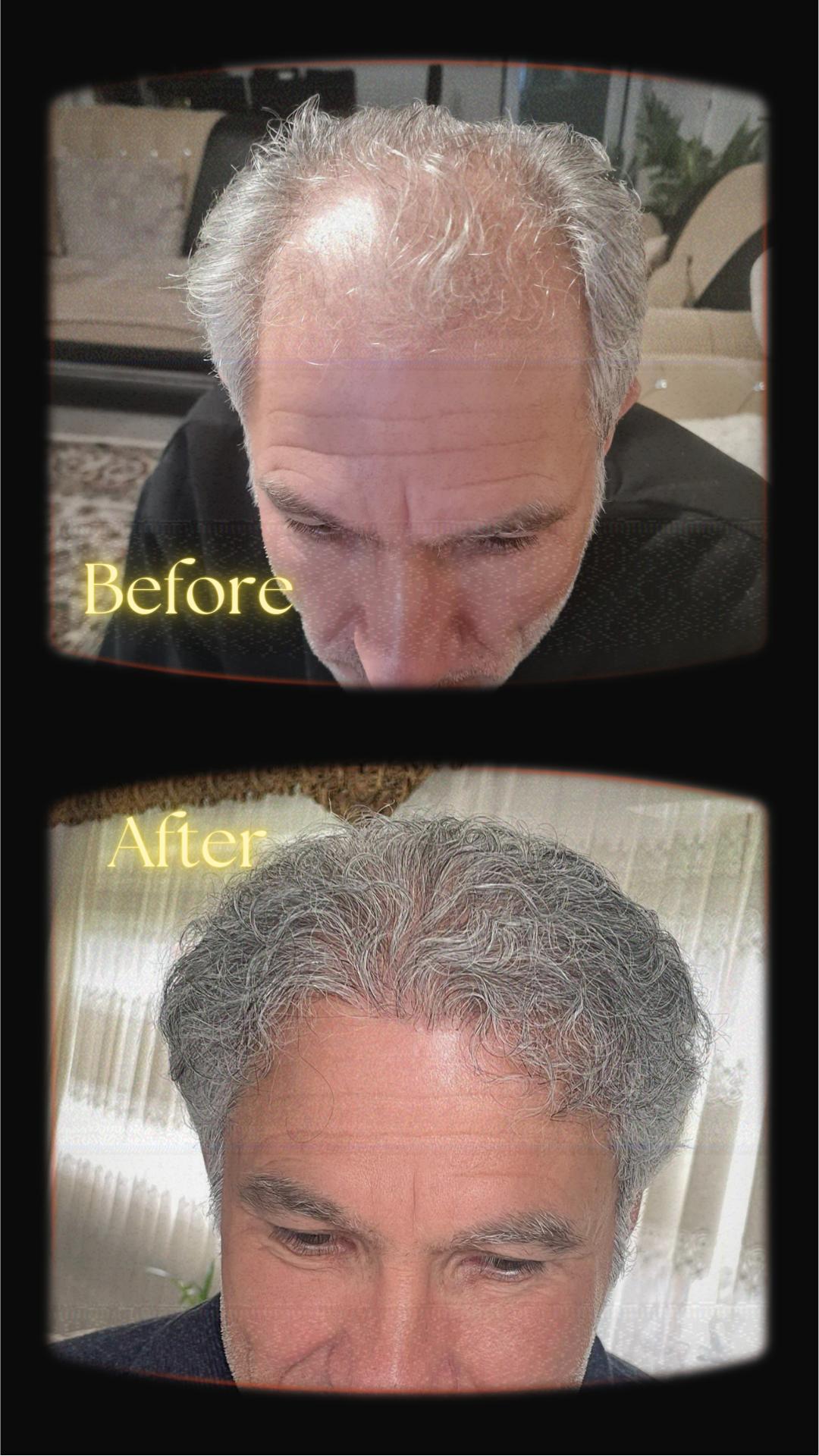 estherian Hair Surgery 4