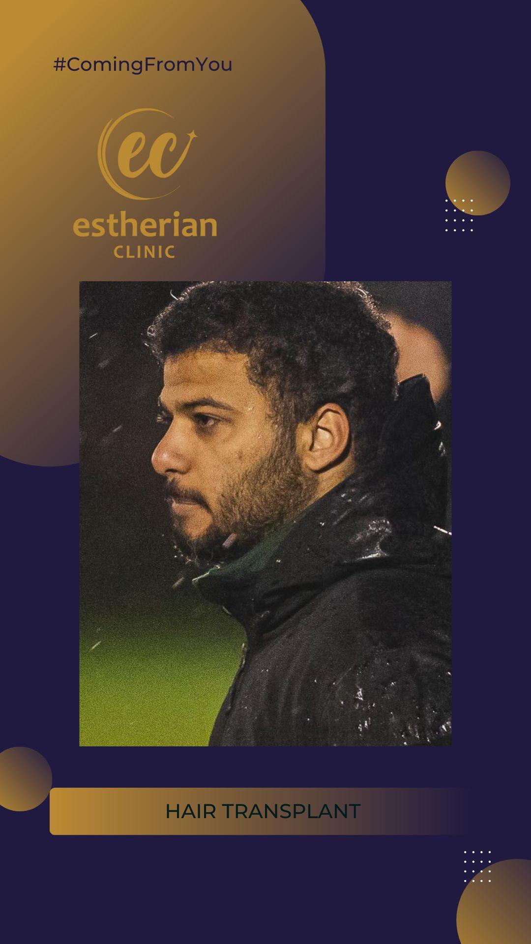 estherian Hair Surgery 5