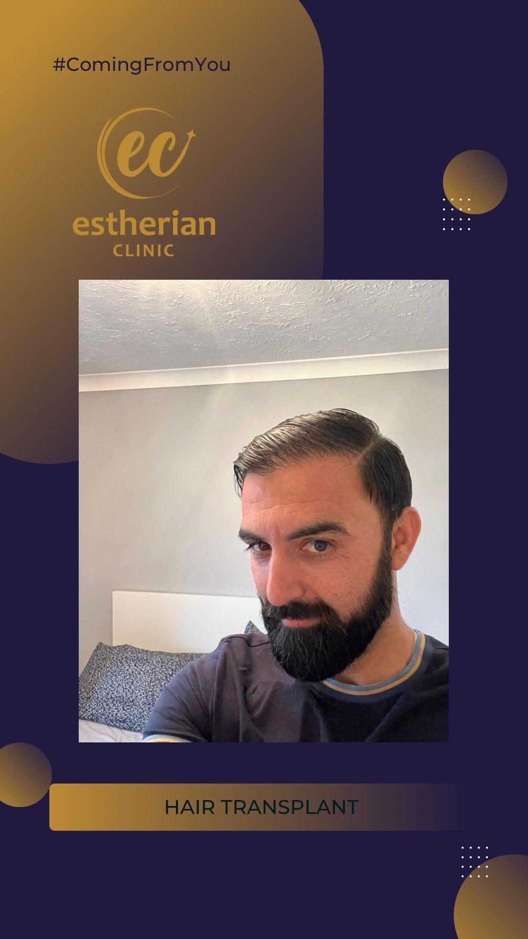 estherian Hair Surgery 6