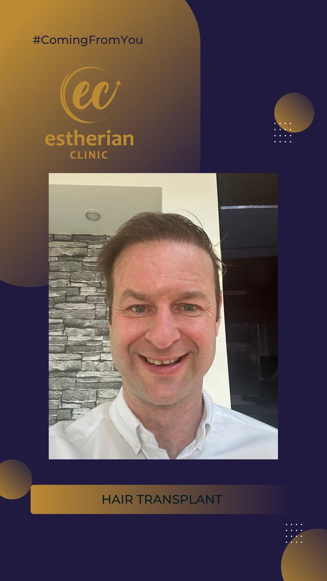 estherian Hair Surgery 7