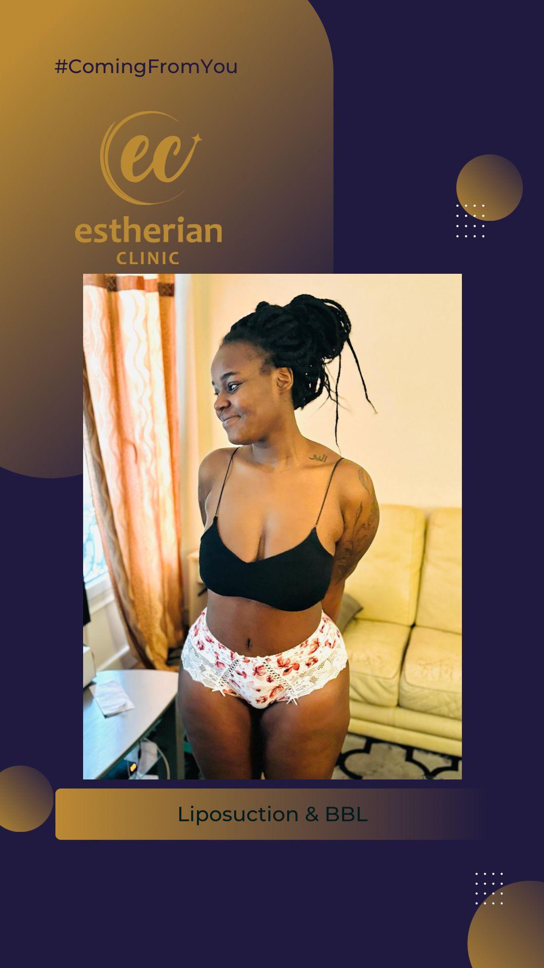 estherian BODY Surgery 6