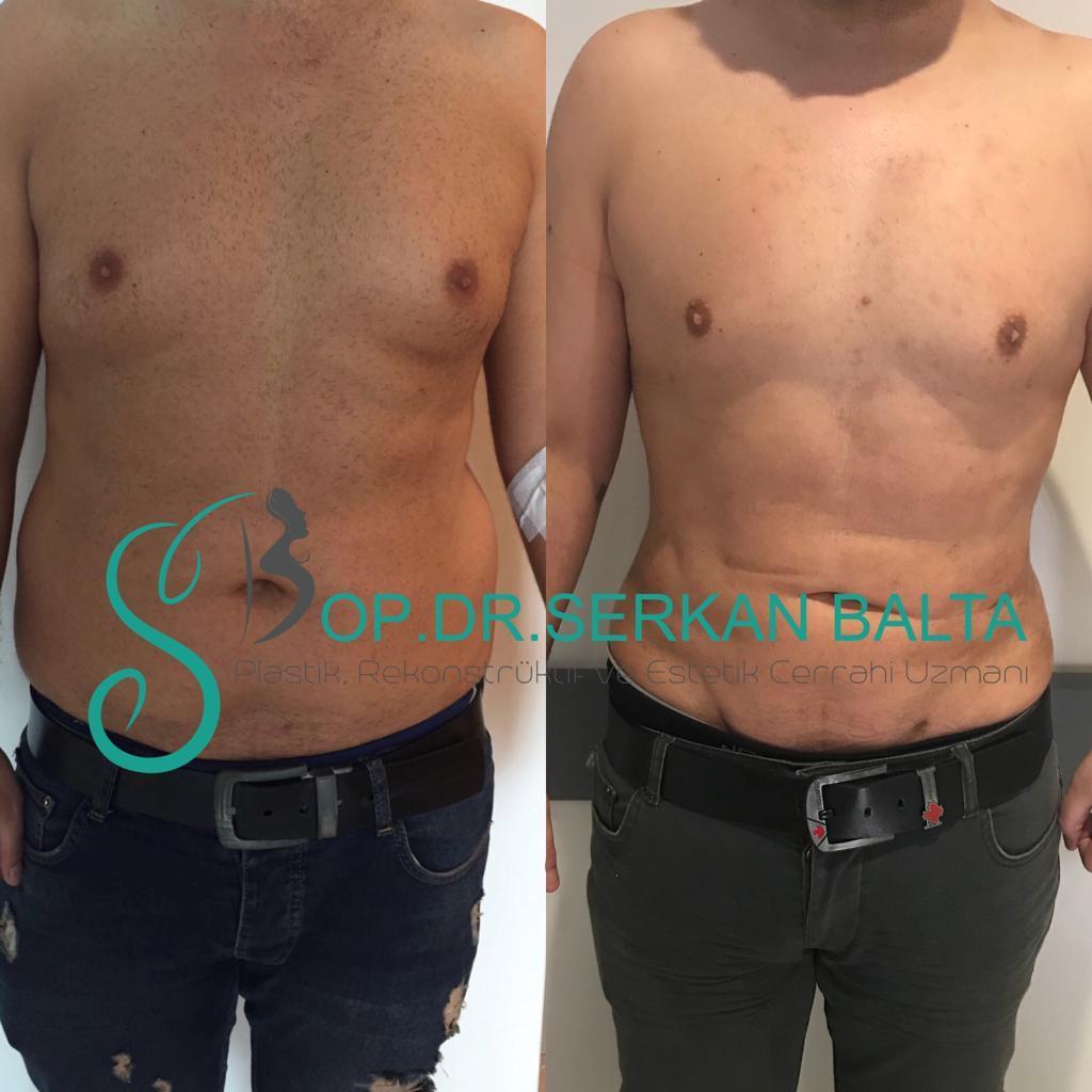 ELIT CLINIC COSMETIC SURGERY RESULTS 5