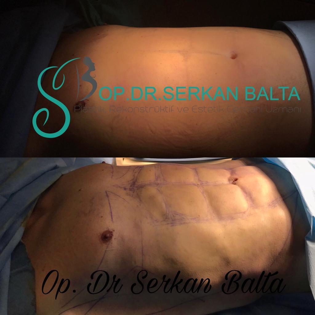 ELIT CLINIC COSMETIC SURGERY RESULTS 2
