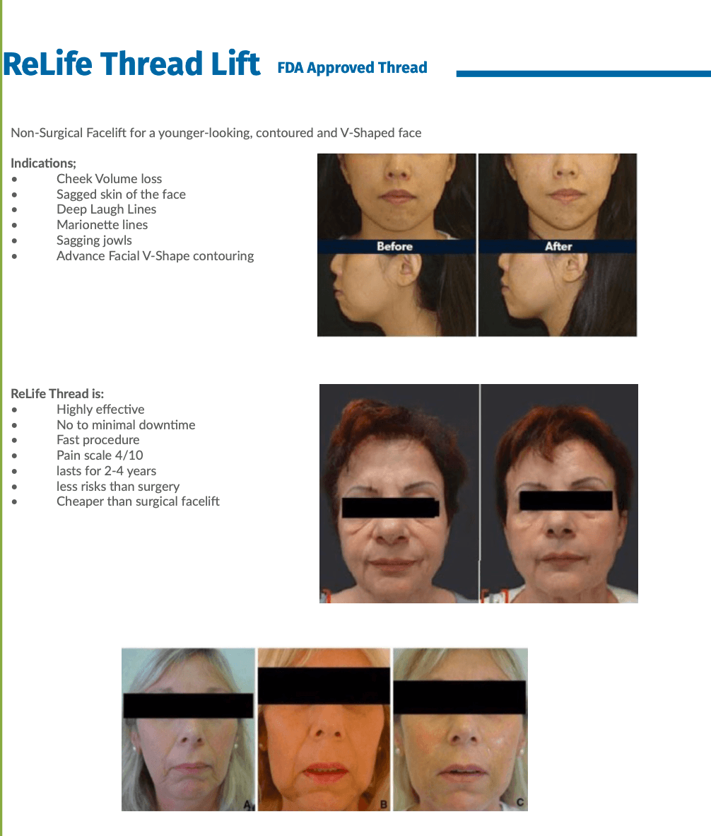 Fils tenseurs Phuket 