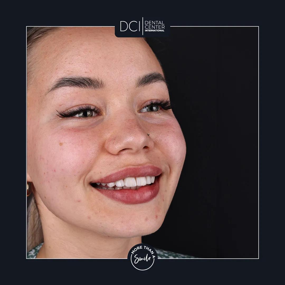 DCI Dental antalya1