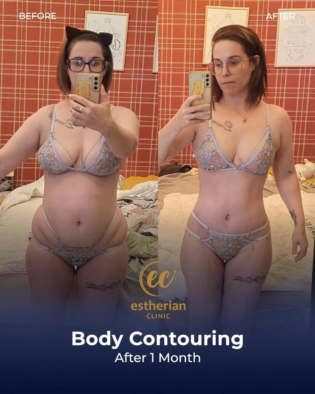 Estherian Clinic Istanbul results9