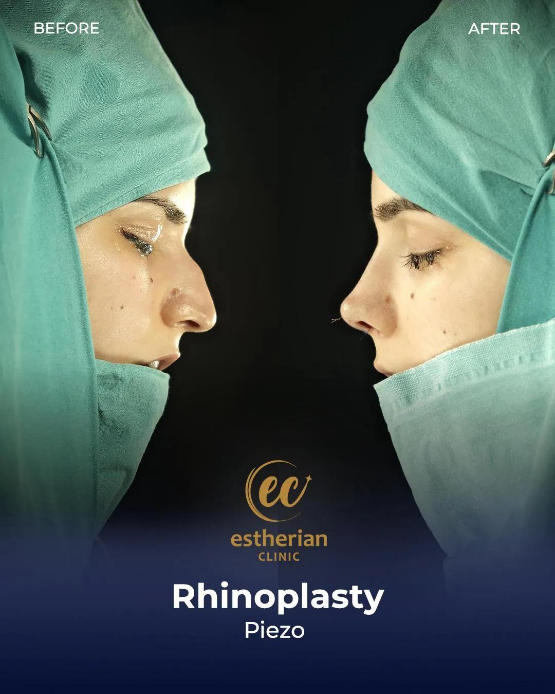 Estherian Clinic Istanbul results4